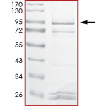 EGFR (L718Q T790M L858R), Active